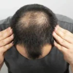 گنج پن
